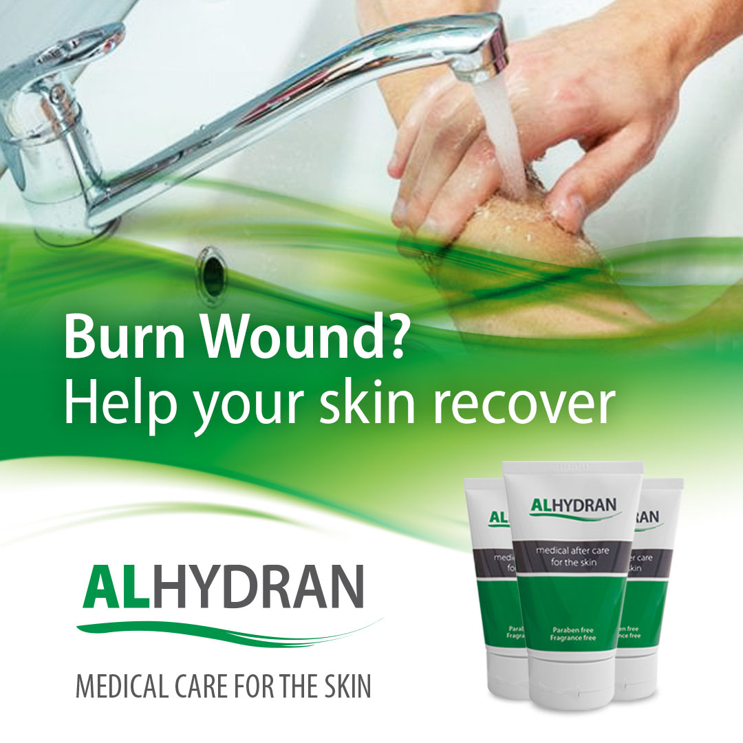 Preventing burn scars